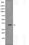 DF5020 staining HeLa by IF/ICC. The sample were fixed with PFA and permeabilized in 0.1% Triton X-100,then blocked in 10% serum for 45 minutes at 25¡ãC. The primary antibody was diluted at 1/200 and incubated with the sample for 1 hour at 37¡ãC. An  Alexa Fluor 594 conjugated goat anti-rabbit IgG (H+L) Ab, diluted at 1/600, was used as the secondary antibod