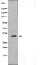 DF5022 staining HeLa by IF/ICC. The sample were fixed with PFA and permeabilized in 0.1% Triton X-100,then blocked in 10% serum for 45 minutes at 25¡ãC. The primary antibody was diluted at 1/200 and incubated with the sample for 1 hour at 37¡ãC. An  Alexa Fluor 594 conjugated goat anti-rabbit IgG (H+L) Ab, diluted at 1/600, was used as the secondary antibod