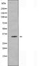 DF5023 staining HuvEc by IF/ICC. The sample were fixed with PFA and permeabilized in 0.1% Triton X-100,then blocked in 10% serum for 45 minutes at 25¡ãC. The primary antibody was diluted at 1/200 and incubated with the sample for 1 hour at 37¡ãC. An  Alexa Fluor 594 conjugated goat anti-rabbit IgG (H+L) Ab, diluted at 1/600, was used as the secondary antibod