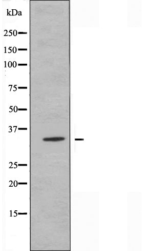 DF5023 staining HuvEc by IF/ICC. The sample were fixed with PFA and permeabilized in 0.1% Triton X-100,then blocked in 10% serum for 45 minutes at 25¡ãC. The primary antibody was diluted at 1/200 and incubated with the sample for 1 hour at 37¡ãC. An  Alexa Fluor 594 conjugated goat anti-rabbit IgG (H+L) Ab, diluted at 1/600, was used as the secondary antibod