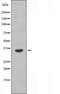 DF5026 staining COLO205 by IF/ICC. The sample were fixed with PFA and permeabilized in 0.1% Triton X-100,then blocked in 10% serum for 45 minutes at 25¡ãC. The primary antibody was diluted at 1/200 and incubated with the sample for 1 hour at 37¡ãC. An  Alexa Fluor 594 conjugated goat anti-rabbit IgG (H+L) Ab, diluted at 1/600, was used as the secondary antibod