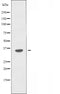 DF5031 staining HeLa by IF/ICC. The sample were fixed with PFA and permeabilized in 0.1% Triton X-100,then blocked in 10% serum for 45 minutes at 25¡ãC. The primary antibody was diluted at 1/200 and incubated with the sample for 1 hour at 37¡ãC. An  Alexa Fluor 594 conjugated goat anti-rabbit IgG (H+L) Ab, diluted at 1/600, was used as the secondary antibod