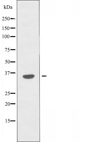 DF5031 staining HeLa by IF/ICC. The sample were fixed with PFA and permeabilized in 0.1% Triton X-100,then blocked in 10% serum for 45 minutes at 25¡ãC. The primary antibody was diluted at 1/200 and incubated with the sample for 1 hour at 37¡ãC. An  Alexa Fluor 594 conjugated goat anti-rabbit IgG (H+L) Ab, diluted at 1/600, was used as the secondary antibod