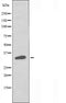DF5034 staining HuvEc by IF/ICC. The sample were fixed with PFA and permeabilized in 0.1% Triton X-100,then blocked in 10% serum for 45 minutes at 25¡ãC. The primary antibody was diluted at 1/200 and incubated with the sample for 1 hour at 37¡ãC. An  Alexa Fluor 594 conjugated goat anti-rabbit IgG (H+L) Ab, diluted at 1/600, was used as the secondary antibod