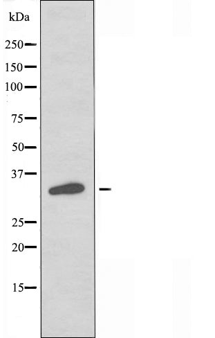 DF5034 staining HuvEc by IF/ICC. The sample were fixed with PFA and permeabilized in 0.1% Triton X-100,then blocked in 10% serum for 45 minutes at 25¡ãC. The primary antibody was diluted at 1/200 and incubated with the sample for 1 hour at 37¡ãC. An  Alexa Fluor 594 conjugated goat anti-rabbit IgG (H+L) Ab, diluted at 1/600, was used as the secondary antibod
