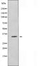 DF5040 staining HepG2 by IF/ICC. The sample were fixed with PFA and permeabilized in 0.1% Triton X-100,then blocked in 10% serum for 45 minutes at 25¡ãC. The primary antibody was diluted at 1/200 and incubated with the sample for 1 hour at 37¡ãC. An  Alexa Fluor 594 conjugated goat anti-rabbit IgG (H+L) Ab, diluted at 1/600, was used as the secondary antibod