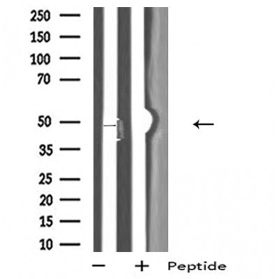 DF5044 staining Hela by IF/ICC. The sample were fixed with PFA and permeabilized in 0.1% Triton X-100,then blocked in 10% serum for 45 minutes at 25¡ãC. The primary antibody was diluted at 1/200 and incubated with the sample for 1 hour at 37¡ãC. An  Alexa Fluor 594 conjugated goat anti-rabbit IgG (H+L) Ab, diluted at 1/600, was used as the secondary antibod
