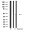 Western blot analysis of extracts from various samples, using OPRM1 Antibody.
 Lane 1: Rat brain treated with blocking peptide.
 Lane 2: Rat brain;
 Lane 3: 293;
 Lane 4: Sp2/0;
 Lane 5: B16F10;
 