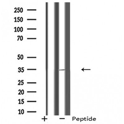 Western blot analysis of extracts from Mouse muscle, using RHO Antibody. The lane on the left was treated with blocking peptide.