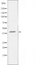 DF5066 staining HeLa by IF/ICC. The sample were fixed with PFA and permeabilized in 0.1% Triton X-100,then blocked in 10% serum for 45 minutes at 25¡ãC. The primary antibody was diluted at 1/200 and incubated with the sample for 1 hour at 37¡ãC. An  Alexa Fluor 594 conjugated goat anti-rabbit IgG (H+L) Ab, diluted at 1/600, was used as the secondary antibod