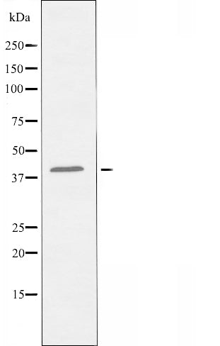 DF5076 staining COLO205 by IF/ICC. The sample were fixed with PFA and permeabilized in 0.1% Triton X-100,then blocked in 10% serum for 45 minutes at 25¡ãC. The primary antibody was diluted at 1/200 and incubated with the sample for 1 hour at 37¡ãC. An  Alexa Fluor 594 conjugated goat anti-rabbit IgG (H+L) Ab, diluted at 1/600, was used as the secondary antibod