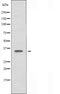 DF5087 staining HeLa by IF/ICC. The sample were fixed with PFA and permeabilized in 0.1% Triton X-100,then blocked in 10% serum for 45 minutes at 25¡ãC. The primary antibody was diluted at 1/200 and incubated with the sample for 1 hour at 37¡ãC. An  Alexa Fluor 594 conjugated goat anti-rabbit IgG (H+L) Ab, diluted at 1/600, was used as the secondary antibod