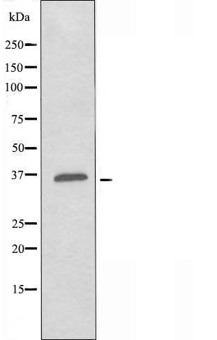 DF5125 staining HeLa by IF/ICC. The sample were fixed with PFA and permeabilized in 0.1% Triton X-100,then blocked in 10% serum for 45 minutes at 25¡ãC. The primary antibody was diluted at 1/200 and incubated with the sample for 1 hour at 37¡ãC. An  Alexa Fluor 594 conjugated goat anti-rabbit IgG (H+L) Ab, diluted at 1/600, was used as the secondary antibod