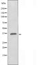 DF5125 staining HeLa by IF/ICC. The sample were fixed with PFA and permeabilized in 0.1% Triton X-100,then blocked in 10% serum for 45 minutes at 25¡ãC. The primary antibody was diluted at 1/200 and incubated with the sample for 1 hour at 37¡ãC. An  Alexa Fluor 594 conjugated goat anti-rabbit IgG (H+L) Ab, diluted at 1/600, was used as the secondary antibod