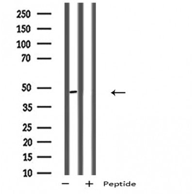 DF5138 staining HepG2 by IF/ICC. The sample were fixed with PFA and permeabilized in 0.1% Triton X-100,then blocked in 10% serum for 45 minutes at 25¡ãC. The primary antibody was diluted at 1/200 and incubated with the sample for 1 hour at 37¡ãC. An  Alexa Fluor 594 conjugated goat anti-rabbit IgG (H+L) Ab, diluted at 1/600, was used as the secondary antibod