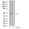DF5138 staining HepG2 by IF/ICC. The sample were fixed with PFA and permeabilized in 0.1% Triton X-100,then blocked in 10% serum for 45 minutes at 25¡ãC. The primary antibody was diluted at 1/200 and incubated with the sample for 1 hour at 37¡ãC. An  Alexa Fluor 594 conjugated goat anti-rabbit IgG (H+L) Ab, diluted at 1/600, was used as the secondary antibod