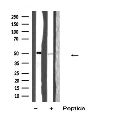 DF5147 staining Hela by IF/ICC. The sample were fixed with PFA and permeabilized in 0.1% Triton X-100,then blocked in 10% serum for 45 minutes at 25¡ãC. The primary antibody was diluted at 1/200 and incubated with the sample for 1 hour at 37¡ãC. An  Alexa Fluor 594 conjugated goat anti-rabbit IgG (H+L) Ab, diluted at 1/600, was used as the secondary antibod
