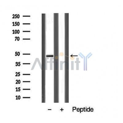DF5170 staining  COLO205 cells by IF/ICC. The sample were fixed with PFA and permeabilized in 0.1% Triton X-100,then blocked in 10% serum for 45 minutes at 25¡ãC. The primary antibody was diluted at 1/200 and incubated with the sample for 1 hour at 37¡ãC. An  Alexa Fluor 594 conjugated goat anti-rabbit IgG (H+L) antibody(Cat.# S0006), diluted at 1/600, was used as secondary antibod