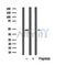 DF5170 staining  COLO205 cells by IF/ICC. The sample were fixed with PFA and permeabilized in 0.1% Triton X-100,then blocked in 10% serum for 45 minutes at 25¡ãC. The primary antibody was diluted at 1/200 and incubated with the sample for 1 hour at 37¡ãC. An  Alexa Fluor 594 conjugated goat anti-rabbit IgG (H+L) antibody(Cat.# S0006), diluted at 1/600, was used as secondary antibod