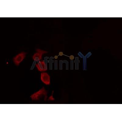 Western blot analysis of extracts from rat muscle, using AVPR2 Antibody. Lane 1 was treated with the antigen-specific peptide.