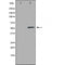 DF5172 staining HT29 by IF/ICC. The sample were fixed with PFA and permeabilized in 0.1% Triton X-100,then blocked in 10% serum for 45 minutes at 25¡ãC. The primary antibody was diluted at 1/200 and incubated with the sample for 1 hour at 37¡ãC. An  Alexa Fluor 594 conjugated goat anti-rabbit IgG (H+L) Ab, diluted at 1/600, was used as the secondary antibod