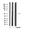Western blot analysis of extracts from Hela, using VIPR2 Antibody. Lane 1 was treated with the blocking peptide.
