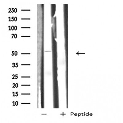 DF5176 at 1/100 staining Mouse intestine tissue by IHC-P. The sample was formaldehyde fixed and a heat mediated antigen retrieval step in citrate buffer was performed. The sample was then blocked and incubated with the antibody for 1.5 hours at 22¡ãC. An HRP conjugated goat anti-rabbit antibody was used as the secondary