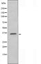 DF5178 staining Hela by IF/ICC. The sample were fixed with PFA and permeabilized in 0.1% Triton X-100,then blocked in 10% serum for 45 minutes at 25¡ãC. The primary antibody was diluted at 1/200 and incubated with the sample for 1 hour at 37¡ãC. An  Alexa Fluor 594 conjugated goat anti-rabbit IgG (H+L) Ab, diluted at 1/600, was used as the secondary antibod