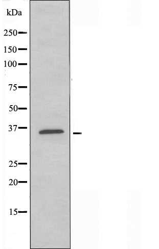 DF5183 staining HeLa by IF/ICC. The sample were fixed with PFA and permeabilized in 0.1% Triton X-100,then blocked in 10% serum for 45 minutes at 25¡ãC. The primary antibody was diluted at 1/200 and incubated with the sample for 1 hour at 37¡ãC. An  Alexa Fluor 594 conjugated goat anti-rabbit IgG (H+L) Ab, diluted at 1/600, was used as the secondary antibod