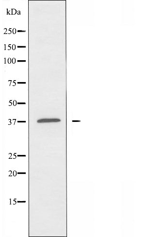 DF5185 staining Hela by IF/ICC. The sample were fixed with PFA and permeabilized in 0.1% Triton X-100,then blocked in 10% serum for 45 minutes at 25¡ãC. The primary antibody was diluted at 1/200 and incubated with the sample for 1 hour at 37¡ãC. An  Alexa Fluor 594 conjugated goat anti-rabbit IgG (H+L) Ab, diluted at 1/600, was used as the secondary antibod