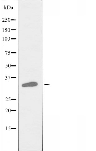 DF5189 staining Hela by IF/ICC. The sample were fixed with PFA and permeabilized in 0.1% Triton X-100,then blocked in 10% serum for 45 minutes at 25¡ãC. The primary antibody was diluted at 1/200 and incubated with the sample for 1 hour at 37¡ãC. An  Alexa Fluor 594 conjugated goat anti-rabbit IgG (H+L) Ab, diluted at 1/600, was used as the secondary antibod