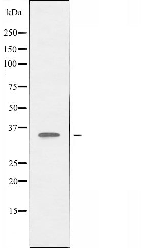 DF5201 staining Hela by IF/ICC. The sample were fixed with PFA and permeabilized in 0.1% Triton X-100,then blocked in 10% serum for 45 minutes at 25¡ãC. The primary antibody was diluted at 1/200 and incubated with the sample for 1 hour at 37¡ãC. An  Alexa Fluor 594 conjugated goat anti-rabbit IgG (H+L) Ab, diluted at 1/600, was used as the secondary antibod