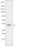 DF5201 staining Hela by IF/ICC. The sample were fixed with PFA and permeabilized in 0.1% Triton X-100,then blocked in 10% serum for 45 minutes at 25¡ãC. The primary antibody was diluted at 1/200 and incubated with the sample for 1 hour at 37¡ãC. An  Alexa Fluor 594 conjugated goat anti-rabbit IgG (H+L) Ab, diluted at 1/600, was used as the secondary antibod