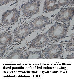 Immunohistochemical staining of formalin fixed paraffin-embedded  colon showing secreted protein staining with anti-VWF antibody diluting 1:100
