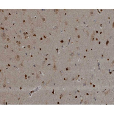 AF0118 at 1/200 staining human brain tissue sections by IHC-P. The tissue was formaldehyde fixed and a heat mediated antigen retrieval step in citrate buffer was performed. The tissue was then blocked and incubated with the antibody for 1.5 hours at 22¡ãC. An HRP conjugated goat anti-rabbit antibody was used as the secondary