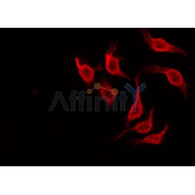 AF0118 staining HeLa by IF/ICC. The sample were fixed with PFA and permeabilized in 0.1% Triton X-100,then blocked in 10% serum for 45 minutes at 25¡ãC. The primary antibody was diluted at 1/200 and incubated with the sample for 1 hour at 37¡ãC. An  Alexa Fluor 594 conjugated goat anti-rabbit IgG (H+L) Ab, diluted at 1/600, was used as the secondary antibod