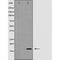 Western blot analysis of Interleukin 2 expression in HT-29 cells,The lane on the left is treated with the antigen-specific peptide.