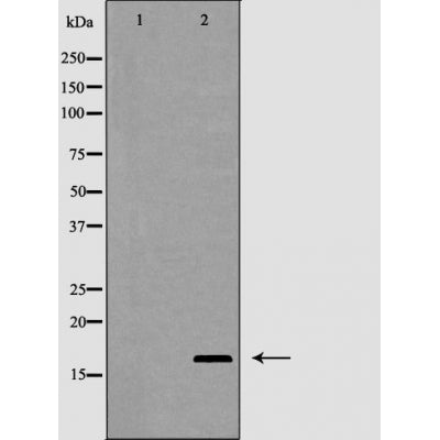 Western blot analysis of Interleukin 2 expression in HT-29 cells,The lane on the left is treated with the antigen-specific peptide.