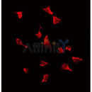 AF5106 at 1/100 staining Human colon cancer tissue by IHC-P. The sample was formaldehyde fixed and a heat mediated antigen retrieval step in citrate buffer was performed. The sample was then blocked and incubated with the antibody for 1.5 hours at 22¡ãC. An HRP conjugated goat anti-rabbit antibody was used as the secondary