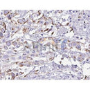 AF5119 staining Hela by IF/ICC. The samples were fixed with PFA and permeabilized in 0.1% Triton X-100,then blocked in 10% serum for 45 minutes at 25¡ãC. Samples were then incubated with primary Ab(AF5119 1:200) and mouse anti-beta tubulin Ab(T0023 1:200) for 1 hour at 37¡ãC. An  AlexaFluor594 conjugated goat anti-rabbit IgG(H+L) Ab(S0006 1:200 Red) and an AlexaFluor488 conjugated goat anti-mouse IgG(H+L) Ab(S0017 1:600 Green) were used as the secondary antibod