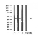 AF5130 at 1/100 staining Mouse colon tissue by IHC-P. The sample was formaldehyde fixed and a heat mediated antigen retrieval step in citrate buffer was performed. The sample was then blocked and incubated with the antibody for 1.5 hours at 22¡ãC. An HRP conjugated goat anti-rabbit antibody was used as the secondary