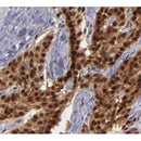AF5136 staining Hela by IF/ICC. The samples were fixed with PFA and permeabilized in 0.1% Triton X-100,then blocked in 10% serum for 45 minutes at 25¡ãC. Samples were then incubated with primary Ab(AF5136 1:200) and mouse anti-beta tubulin Ab(T0023 1:200) for 1 hour at 37¡ãC. An  AlexaFluor594 conjugated goat anti-rabbit IgG(H+L) Ab(S0006 1:200 Red) and an AlexaFluor488 conjugated goat anti-mouse IgG(H+L) Ab(S0017 1:600 Green) were used as the secondary antibod