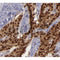 AF5136 staining Hela by IF/ICC. The samples were fixed with PFA and permeabilized in 0.1% Triton X-100,then blocked in 10% serum for 45 minutes at 25¡ãC. Samples were then incubated with primary Ab(AF5136 1:200) and mouse anti-beta tubulin Ab(T0023 1:200) for 1 hour at 37¡ãC. An  AlexaFluor594 conjugated goat anti-rabbit IgG(H+L) Ab(S0006 1:200 Red) and an AlexaFluor488 conjugated goat anti-mouse IgG(H+L) Ab(S0017 1:600 Green) were used as the secondary antibod