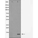 AF5146 at 1/100 staining Human Melanoma tissue by IHC-P. The sample was formaldehyde fixed and a heat mediated antigen retrieval step in citrate buffer was performed. The sample was then blocked and incubated with the antibody for 1.5 hours at 22¡ãC. An HRP conjugated goat anti-rabbit antibody was used as the secondary