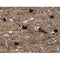 Western blot analysis of extracts from mouse lung tissue,using MAP2 antibody.
Observed bands: 280kDa.