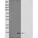 Western blot analysis of Trefoil factor 2?TFF2? expression in HeLa cells,The lane on the left is treated with the antigen-specific peptide.