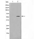 AF5160 at 1/100 staining human lung tissue sections by IHC-P. The tissue was formaldehyde fixed and a heat mediated antigen retrieval step in citrate buffer was performed. The tissue was then blocked and incubated with the antibody for 1.5 hours at 22¡ãC. An HRP conjugated goat anti-rabbit antibody was used as the secondary