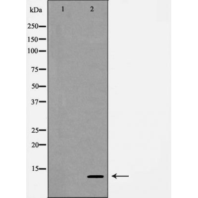 AF5166 at 1/100 staining human colon tissue sections by IHC-P. The tissue was formaldehyde fixed and a heat mediated antigen retrieval step in citrate buffer was performed. The tissue was then blocked and incubated with the antibody for 1.5 hours at 22¡ãC. An HRP conjugated goat anti-rabbit antibody was used as the secondary