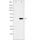 AF5174 staining Hela by IF/ICC. The samples were fixed with PFA and permeabilized in 0.1% Triton X-100,then blocked in 10% serum for 45 minutes at 25¡ãC. Samples were then incubated with primary Ab(AF5174 1:200) and mouse anti-beta tubulin Ab(T0023 1:200) for 1 hour at 37¡ãC. An  AlexaFluor594 conjugated goat anti-rabbit IgG(H+L) Ab(S0006 1:200 Red) and an AlexaFluor488 conjugated goat anti-mouse IgG(H+L) Ab(S0017 1:600 Green) were used as the secondary antibod