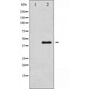 AF5176 at 1/100 staining human lung carcinoma sections by IHC-P. The tissue was formaldehyde fixed and a heat mediated antigen retrieval step in citrate buffer was performed. The tissue was then blocked and incubated with the antibody for 1.5 hours at 22¡ãC. An HRP conjugated goat anti-rabbit antibody was used as the secondary